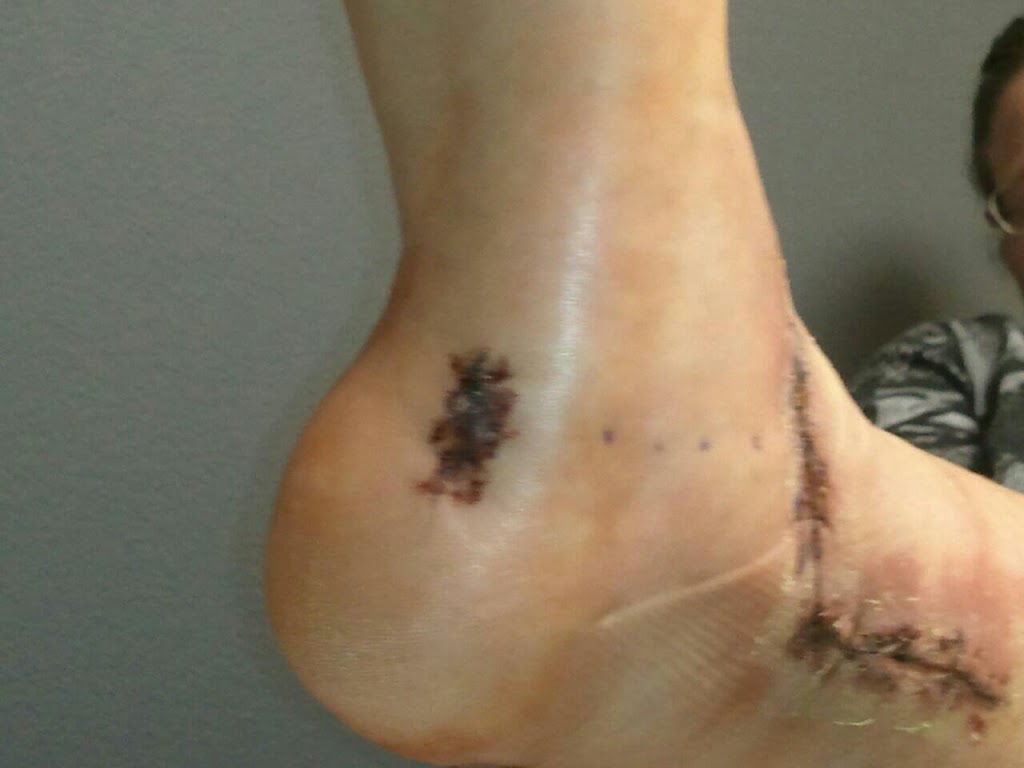 Got my Newest Cast