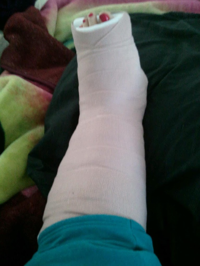 Got NEW Duds on my Leg