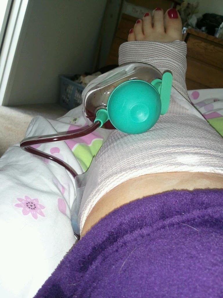 Surgery Day