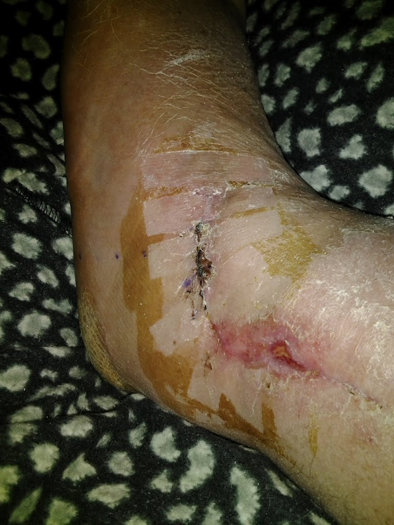 Not looking good….arrgggg